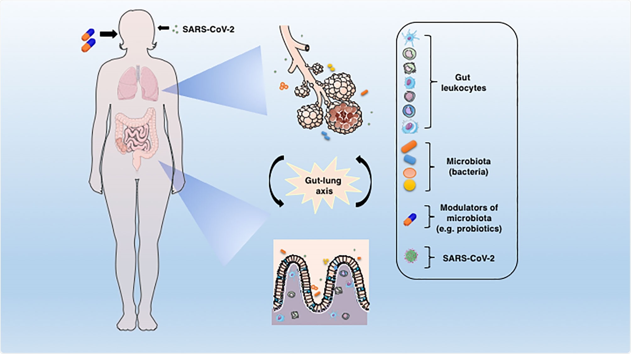 The connection between lung and gut mucosa in the pathogenesis of COVID-19. The SARS-CoV-2 virus infects preferentially cells from the respiratory system, but a large body of evidences points to the GIT as another important target for the virus entry and replication. The dysbiosis, together with the barrier damage and the resulting inflammation may facilitate the disease establishment. The translocated bacteria, leukocytes and the release of inflammatory mediators in the gut-lung axis may contribute to the COVID-19-associated organ deterioration. Some proposed adjunctive therapies such as prebiotics or probiotics, which are aimed at re-establishing the eubiosis state through modulation of microbiota could represent an alternative approach to ameliorate or avoid the worst outcomes of COVID-19.