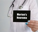 Morton's Neuroma Treatment