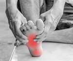 What is Morton's Neuroma?
