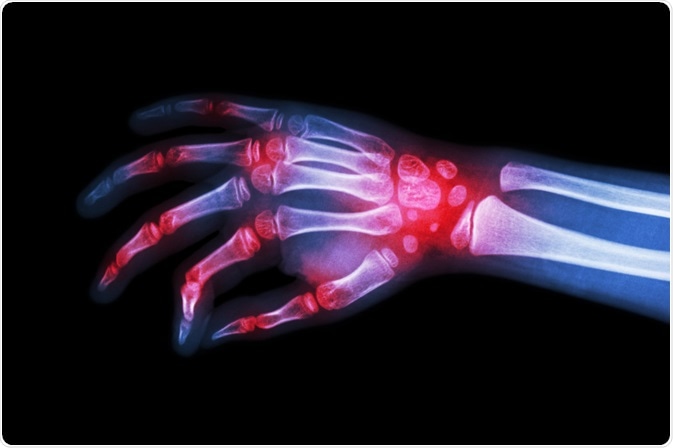 Image Credit: Puwadol Jaturawutthichai / Shutterstock