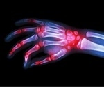 Rheumatology Diagnosis