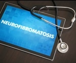 Neurofibromatosis Type 2