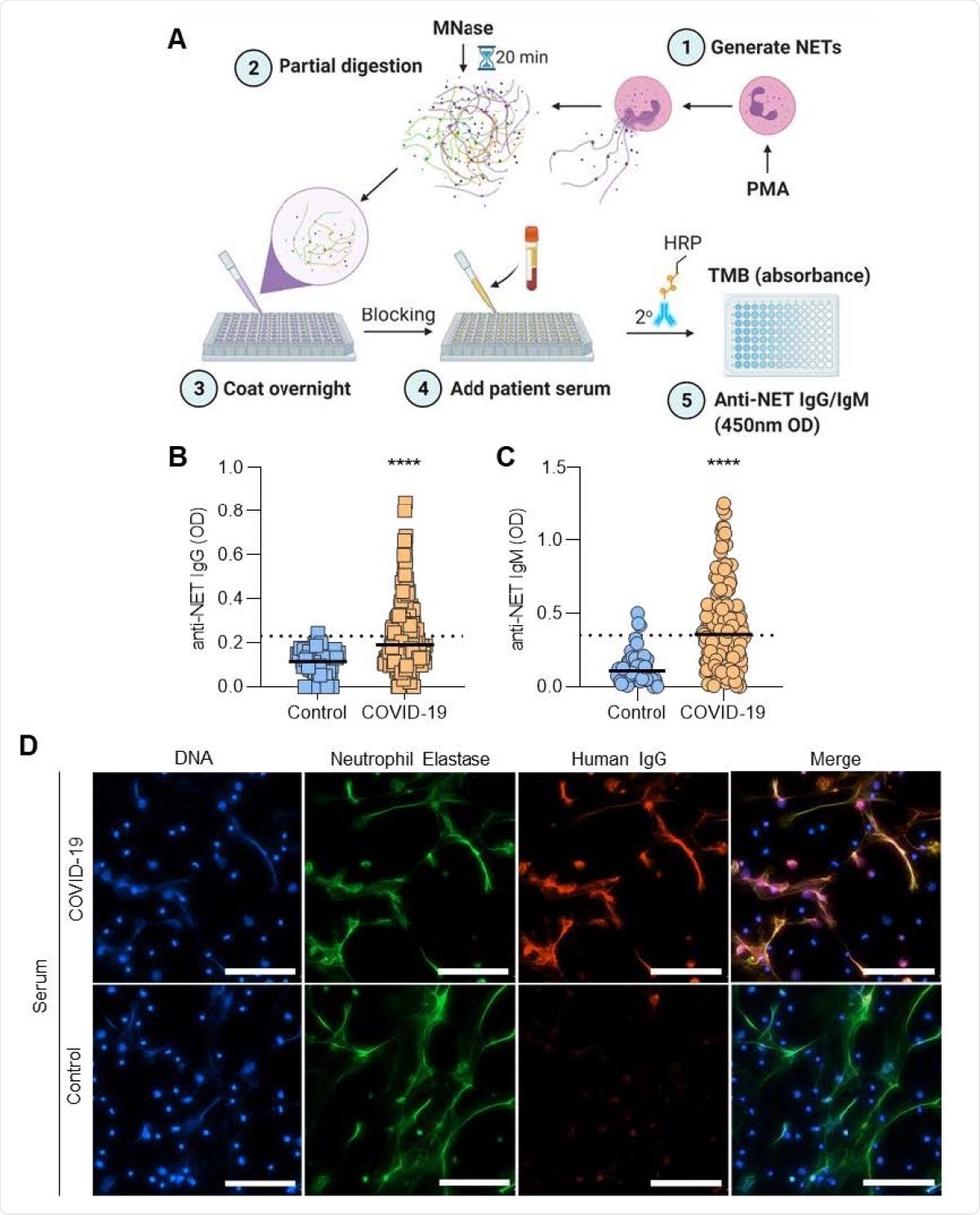 Detection of anti-NET IgG/IgM in sera of COVID-19 patients. A, Schematic illustration of anti-NET ELISA (created with BioRender.com). B-C, Anti-NET IgG and IgM were measured in sera from 171 hospitalized COVID-19 patients and 48 healthy controls. Levels of anti-NET IgG and IgM at 450-nm optical density (OD) were compared by Mann-Whitney test; ****p<0.0001. Dotted lines indicate threshold set at 2 standard deviations above the control mean. D, Control neutrophils were stimulated with PMA to generate NETs. Fixed NETs were then incubated with COVID-19 serum with high anti-NET antibodies or healthy control serum; scale