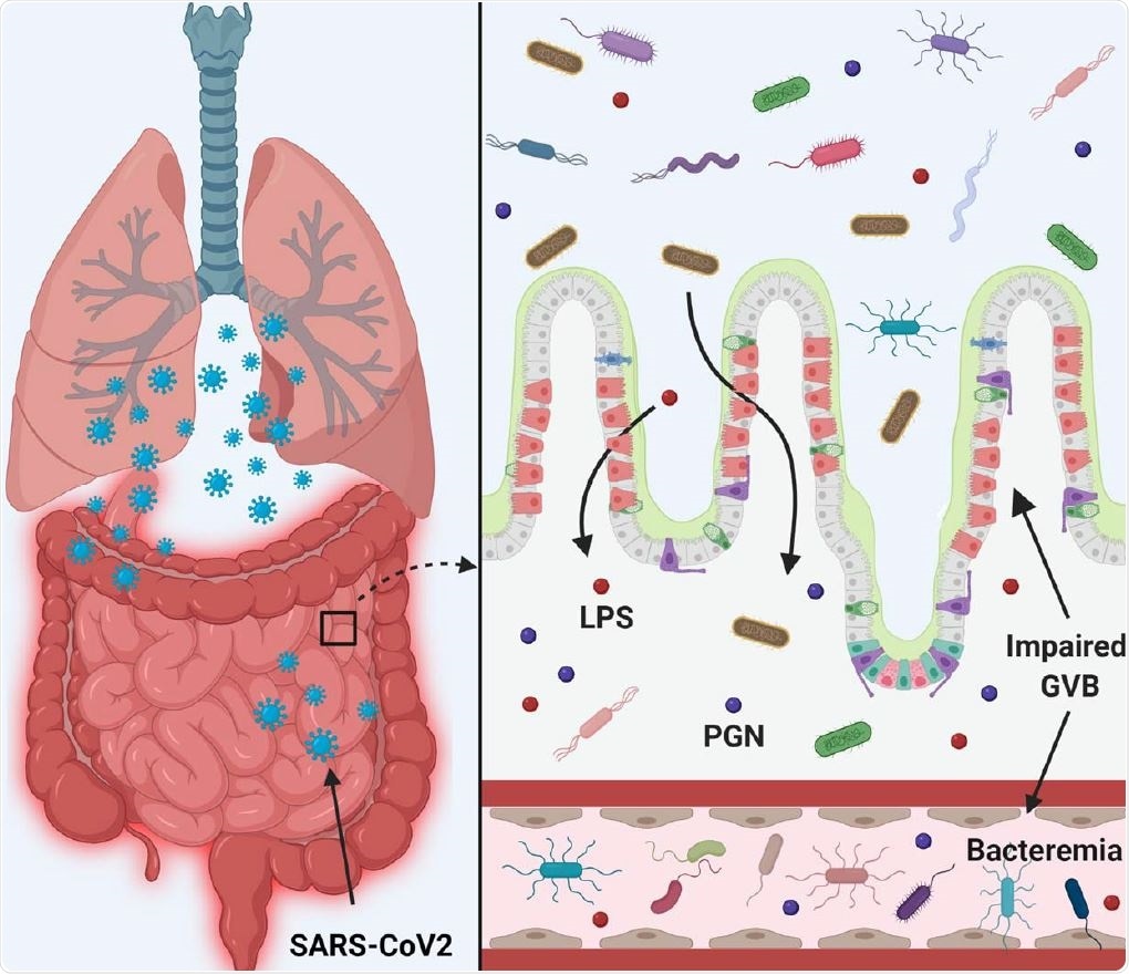 SARS-CoV-2 infection disrupts the gut barrier and leads to elevation of systemic bacterial lipopolysaccharide and peptidoglycan and serves to enhance systemic inflammation. Therefore, leaky gut and microbial dysbiosis could contribute to cytokine storm in patients severely ill with COVID -19.