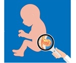 Spina Bifida Pregnancy Screening