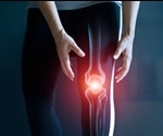 Osteoarthritis Diagnosis
