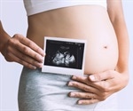 Ultrasound Scans – Is There a Difference Between 3D and 4D Scans?