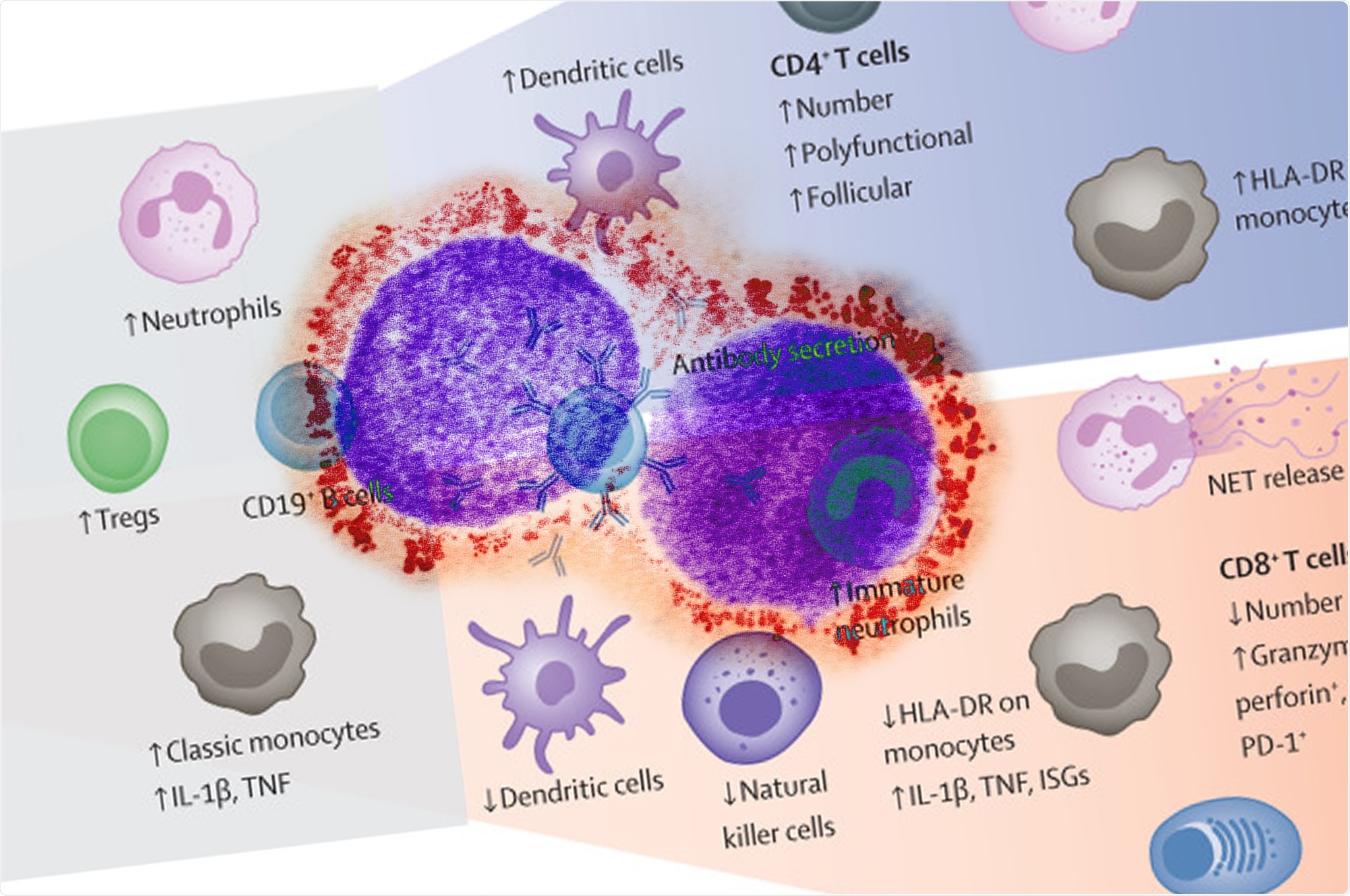 Study: The COVID-19 puzzle: deciphering pathophysiology and phenotypes of a new disease entity. Image Credit: The Lancet: NIAID