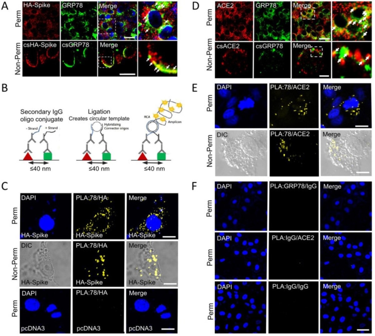GRP78 interactions with SARS-CoV-2 Spike protein and ACE2 by confocal Immunofluorescence and Proximity ligation assay. (A) Confocal immunofluorescence (IF) images of VeroE6-ACE2 cells expressing HA-Spike probed with anti-HA (red) and anti-GRP78 (green) antibodies. The top and bottom row represent permeabilized (Perm) and non-permeabilized (non-Perm) cells respectively. The boxed areas are enlarged on the right. Arrows indicate co-staining. (Scale bars, 20 μm). (B) Schematic diagram of the proximity ligation assay (PLA). (C) VeroE6-ACE2 cells transfected with vector expressing HA-Spike or empty vector (pcDNA3) as indicated were subjected to PLA using antibodies against HA and GRP78. DAPI (blue) represents nuclei staining. Yellow indicates colocalization. (Scale bars, 10 μm). (D) Similar to A except for IF staining for ACE2 (red) and GRP78 (green). (Scale bars, 20 μm top row, 5 μm bottom row). (E) Similar to C except VeroE6-ACE2 cells were subjected to PLA using anti-ACE2 and anti-GRP78 antibodies. (Scale bars, 10 μm). (F) PLA negative control groups. Top row: anti-GRP78 + Rabbit IgG isotype (GRP78/IgG); middle row: anti-ACE2 + Mouse IgG isotype (ACE2/IgG) and bottom row: Mouse IgG + Rabbit IgG (IgG/IgG) in permeabilized VeroE6-ACE2 cells. (Scale bar 40 μm).