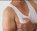 Symptoms of Gynecomastia