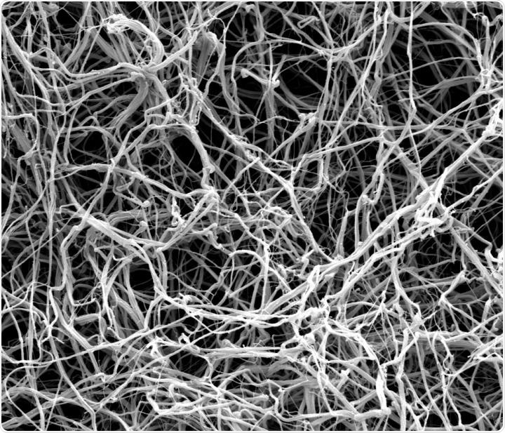 Fibrin Fibers