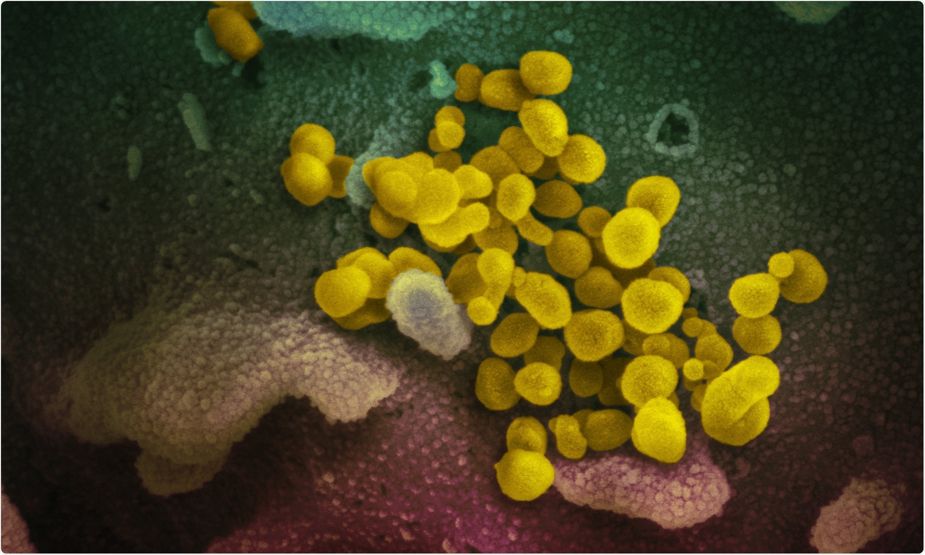 Study: Vaccination reduces need for emergency care in breakthrough COVID-19 infections: A multicenter cohort study. Image Credit: NIAID