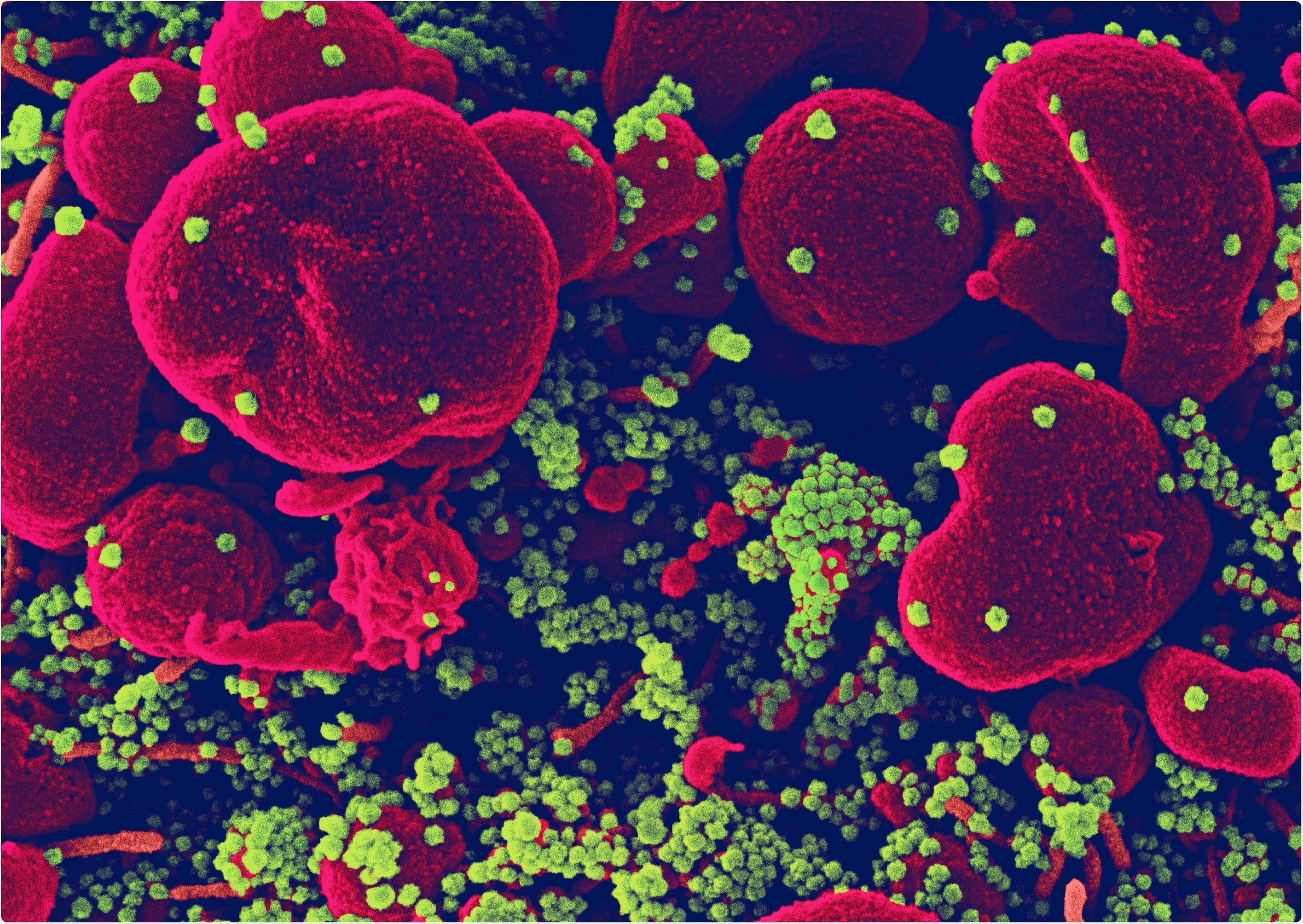 Study: The use of statins was associated with reduced COVID-19 mortality: a systematic review and meta-analysis. Image Credit: NIAID