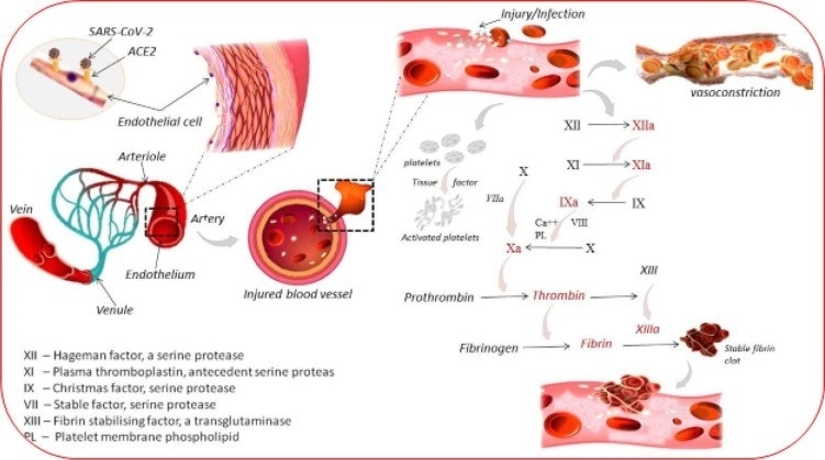 Novel insights can open doors to combating clotting-related problems in COVID-19