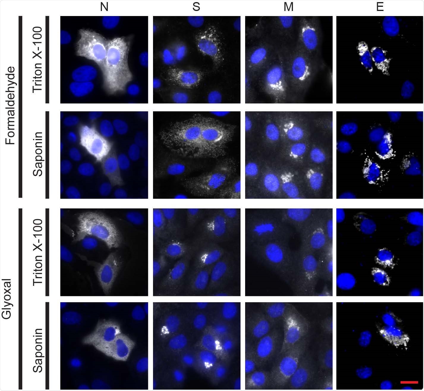Immunostaining of the four structural proteins of SARS-CoV-2 (nucleocapsid (N), spike (S), membrane (M) and envelope (E)) was successful for all fixation conditions and selected antibodies. Vero cells were transfected to express each of the four viral proteins. The immunostaining was successful for all chemical fixation (formaldehyde or glyoxal) and permeabilization (triton X-100 or saponin) conditions tested. The spike protein pattern was different in the two fixation conditions tested, although this difference was not noticed in the infected samples. Nucleocapsid protein was detected using an Alexa Fluor 568-conjugated secondary antibody; spike, membrane and envelope proteins were detected using Alexa Fluor 488-conjugated secondary antibodies. White channel: SARS-CoV-2 proteins; blue channel: DAPI-stained nuclei. All pictures shown were acquired on a custom-built widefield microscope. Scale bar: 20 μm.