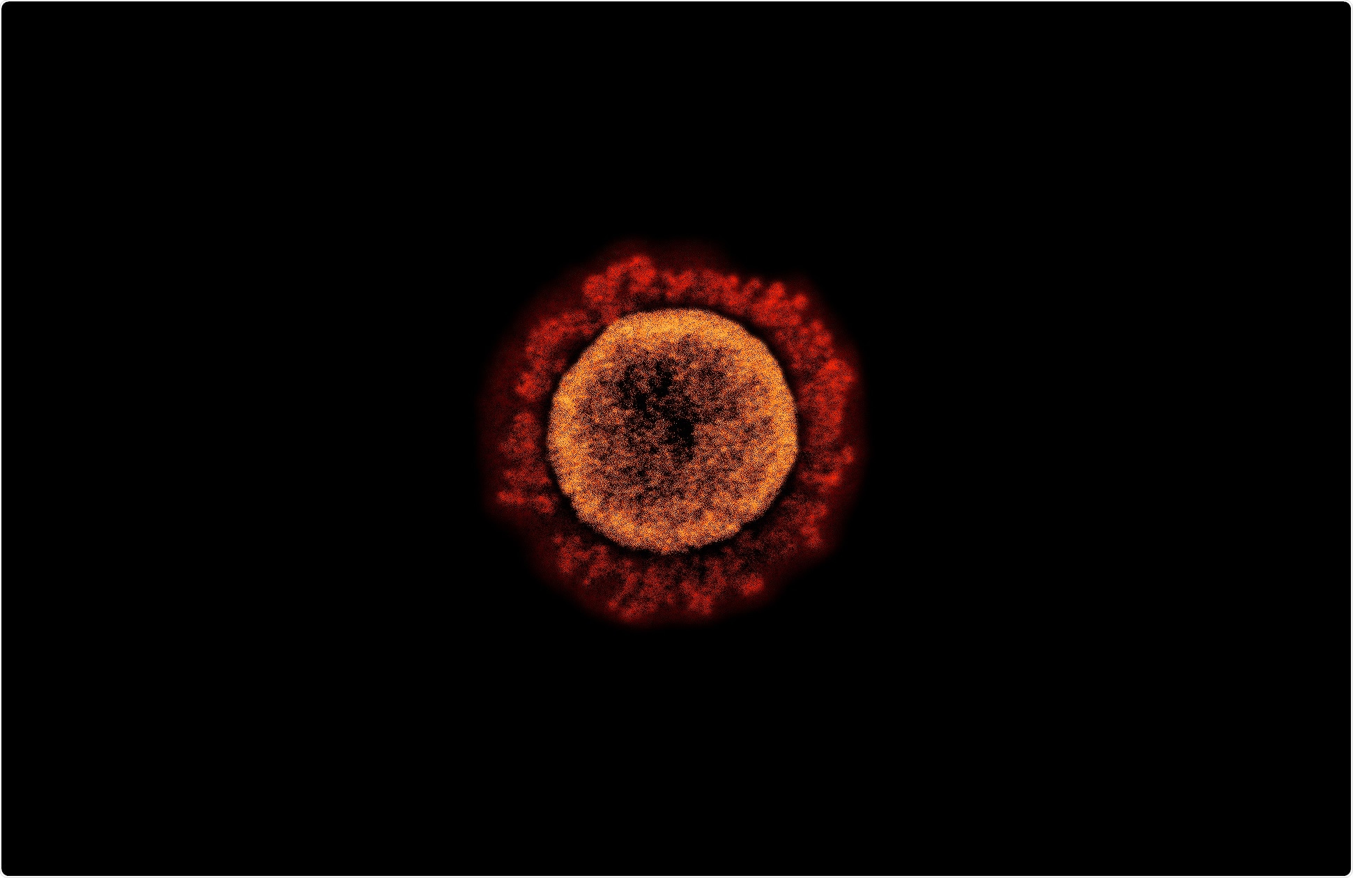Study: Low dose mRNA-1273 COVID-19 vaccine generates durable T cell memory and antibodies enhanced by pre-existing crossreactive T cell memory. Image Credit: NIAID