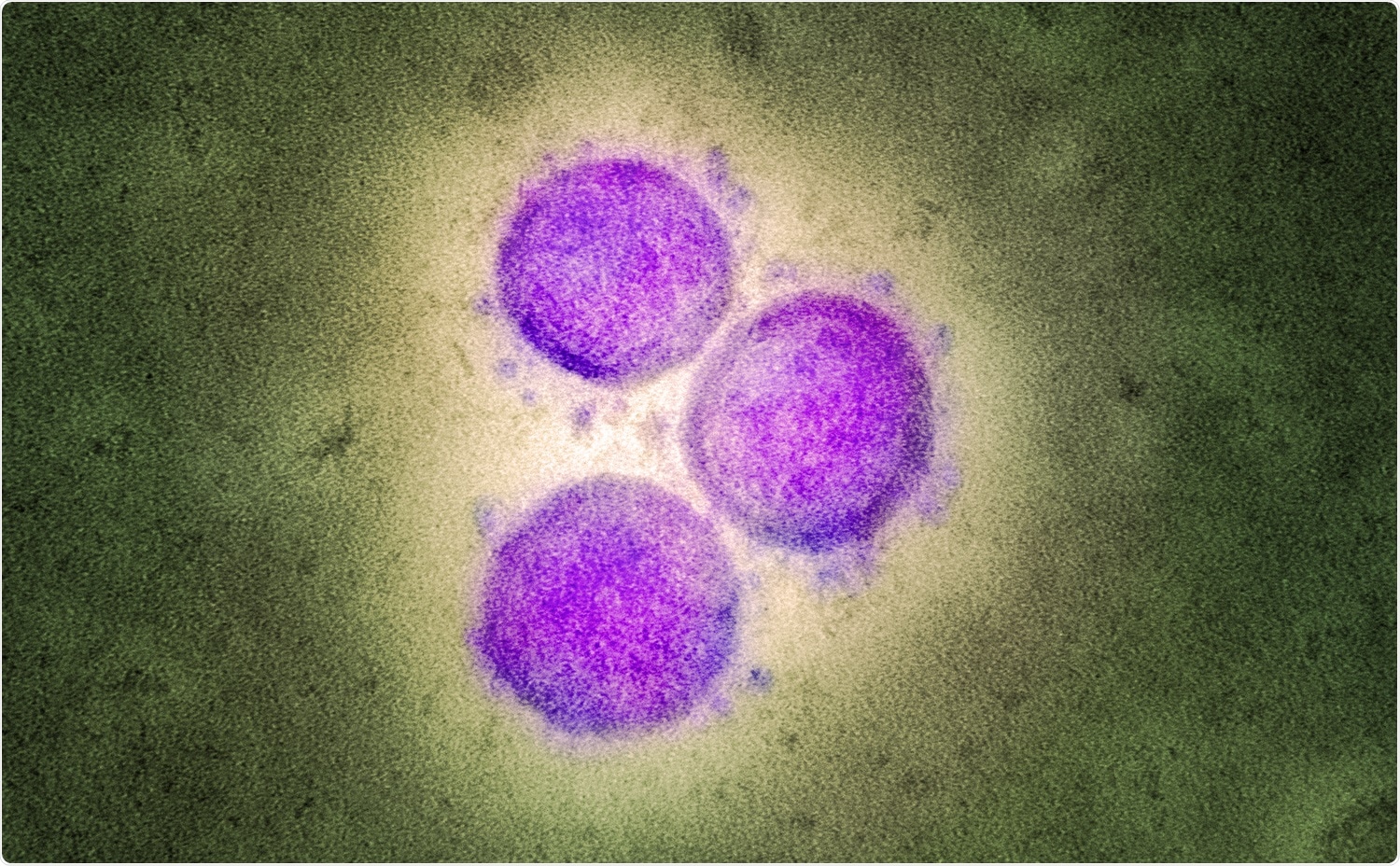 Transmission electron micrograph of SARS-CoV-2 virus particles. Image Credit: NIAID