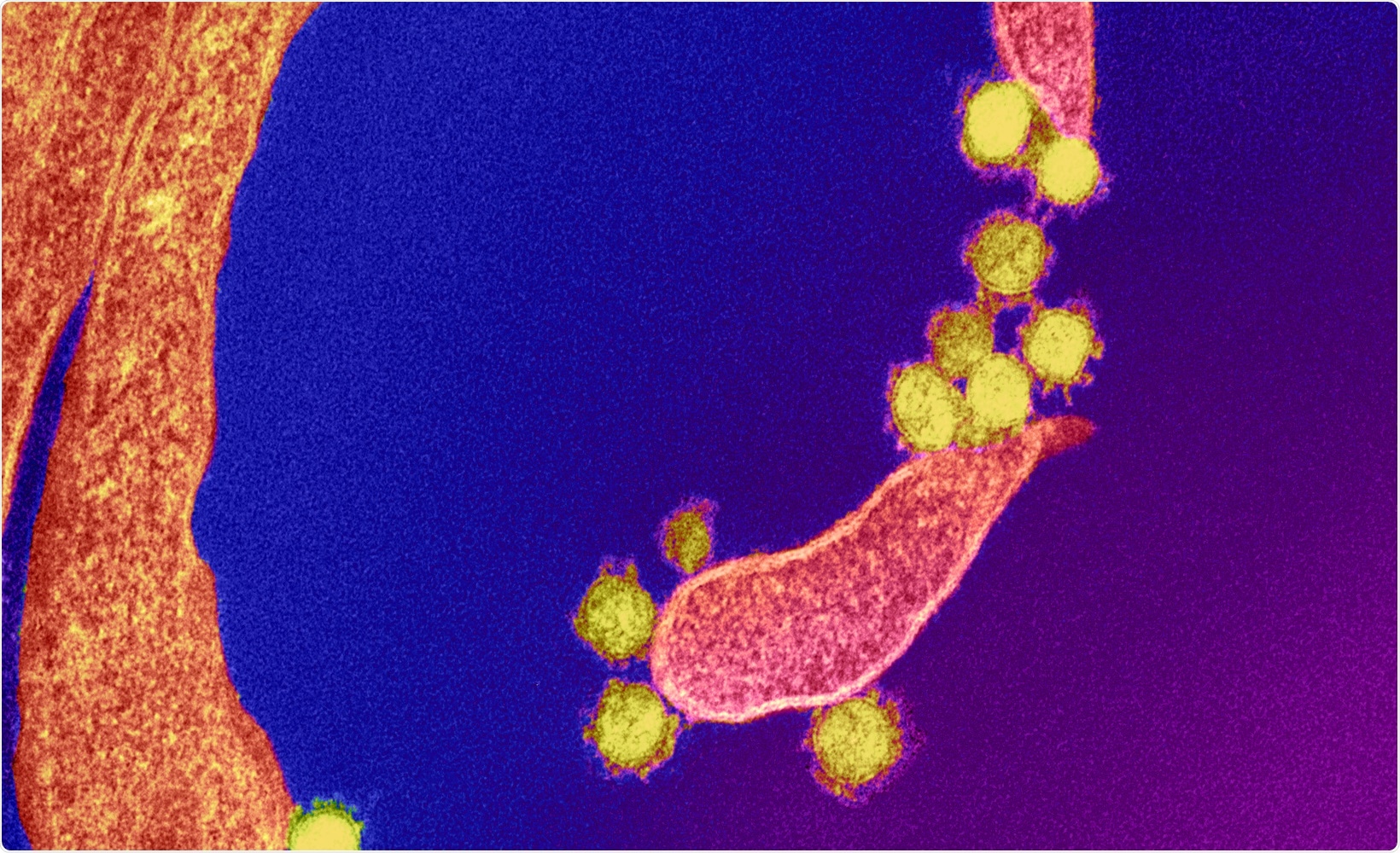 Study: Pre-vaccination and early B cell signatures predict antibody response to SARS-CoV-2 mRNA vaccine. Image Credit: NIAID