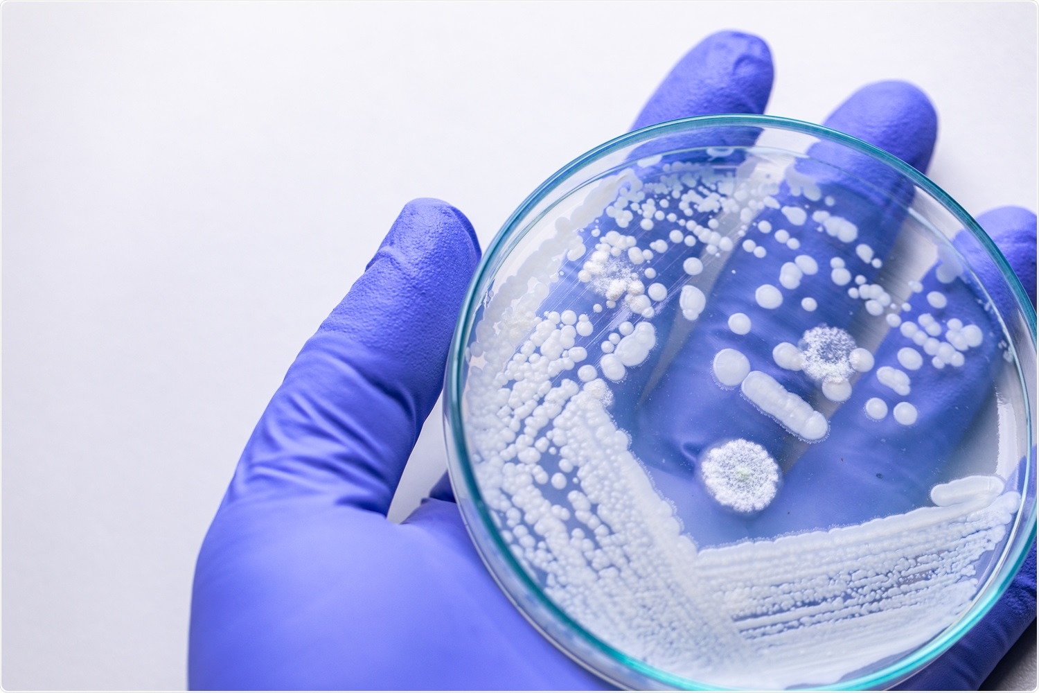 Pichia pastoris. Image Credit: Rattiya Thongdumhyu / Shutterstock