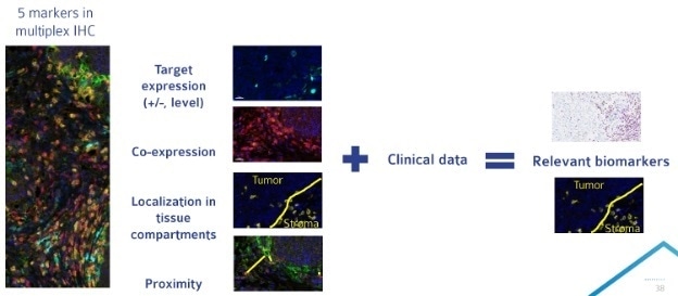 Multiplex IHC allows for analysis of a large number of parameters on a single tissue section. Compiling multiplex IHC results with clinical data can allow for the identification of a more targeted biomarker approach for late phase clinical trials.