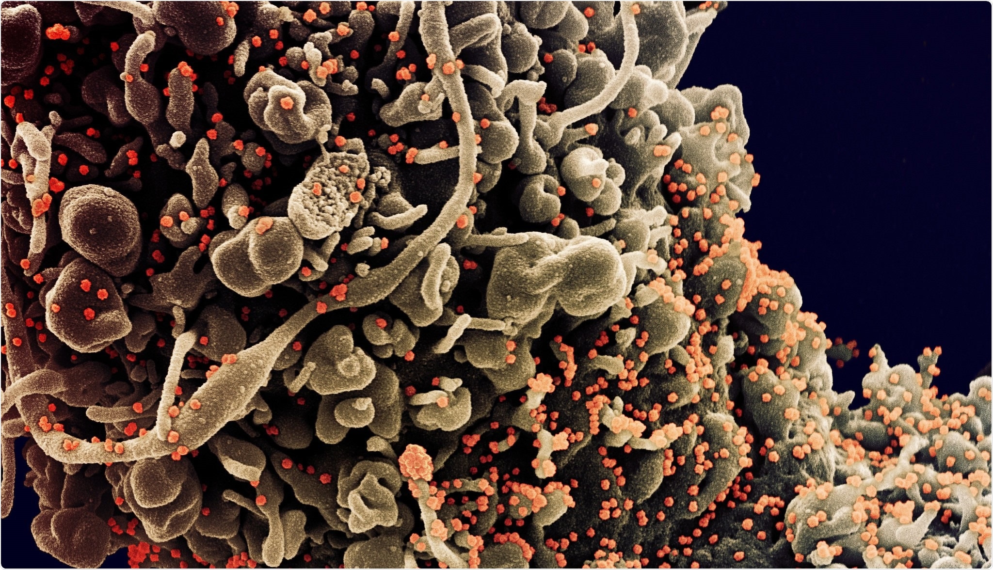 Study: (A) Correlation between full vaccinated rate [13] and mutation frequency (Mf) from June 20 to July 3 2021 in 20 countries: Australia (AUS), France (FRA), Germany (GER), Indonesia (IDA), India (IND), Ireland (IRL), Israel (ISR), Italy (ITA), Japan (JPN), Mexico (MEX), Netherland (NED), Norway (NOR), Portugal (POR), Singapore (SGP), Spain (ESP), Switzerland (SUI), Sweden (SWE), Turkey (TUR), United States (USA), and UK. Logarithmic regression (solid) line was draw based on 16 countries (pink dots) with a calculated 95% confidence interval (dashed lines). Japan, Switzerland, USA, and Australia are labeled in different colors as outliers. (B and C) Chronology of nucleotide diversity (π) (B) and Tajima D’ value (C) of SARS CoV-2 delta variants in UK (N=27,344, blue), Indian (N=4,451, red), and Australian (N=305, green). Data were plotted every two weeks, and the data only represent the effective population size with more than 3 high quality sequences. The arrows label the epidemiological events of COVID-19 delta variants announced by the World Health Organization (WHO). WHO classified the delta variant as a global variant of interest (VOI) on 4 April 2021, and variants of concern (VOC) on 11 May 2021 [5]. The dashed line in (C) labels the cut-off threshold -2.50 in Tajima D’ test.. Image Credit: NIAID