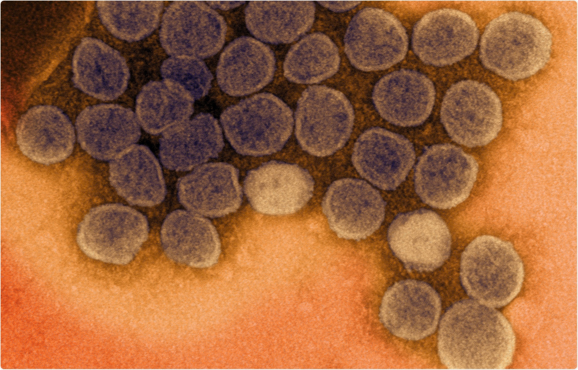 Study: An Oral SARS-CoV-2 Mpro Inhibitor Clinical Candidate for the Treatment of COVID-19. Image Credit: NIAID