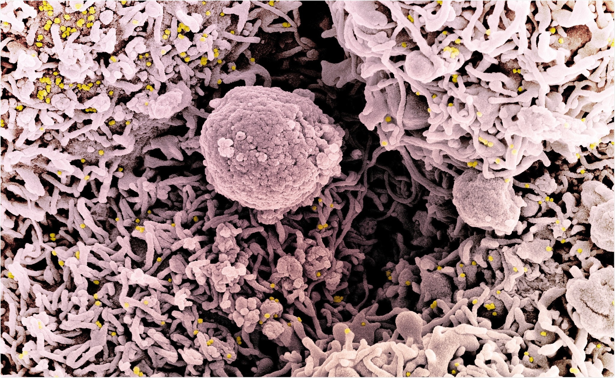 Study: Protection against SARS-CoV-2 Beta Variant in mRNA-1273 Boosted Nonhuman Primates. Image Credit: NIAID