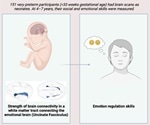 Strength of brain connections in premature infants may predict future emotional development
