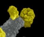 Super-resolution imaging and size analysis of SARS-CoV-2 virus particles