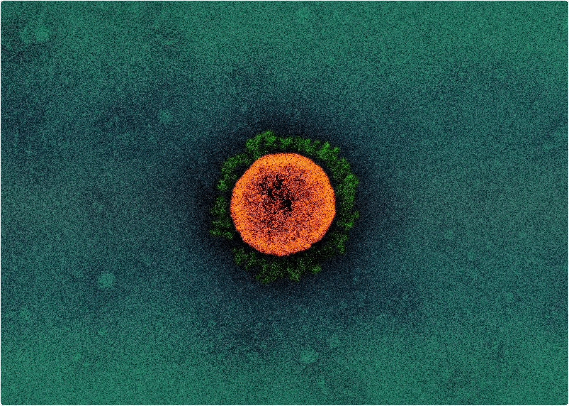 Study: Relationship between COVID-19 infection and neurodegeneration: Computational insight into interactions between the SARS-CoV-2 spike protein and the monoamine oxidase enzymes Image Credit: NIAID