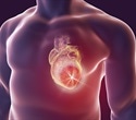 The Connection between High-sensitivity Troponin and Heart Attacks