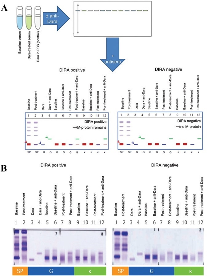 Daratumumab-specific IFE reflex assay.