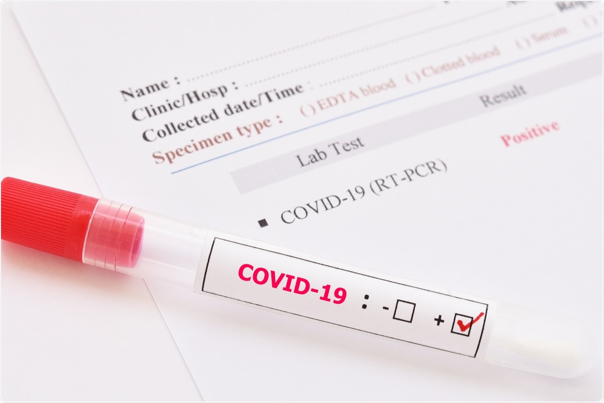 Study: SARS-CoV-2 Virus Dynamics in Recently Infected People – Data from A Household Transmission Study. Image Credit: Jarun Ontakrai / Shutterstock.com