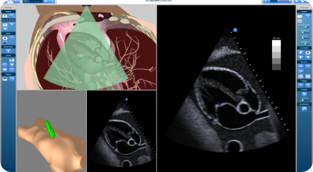 An_Acheived_TCP_450_247_s_c1