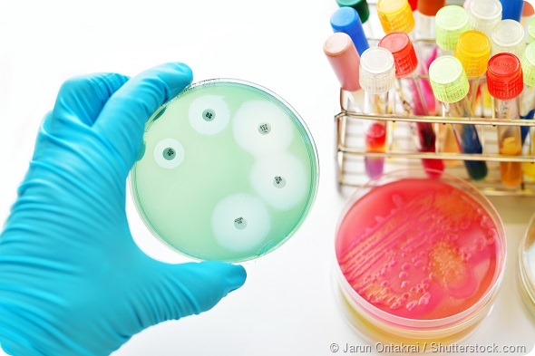 Antimicrobial susceptibility testing in petri dish