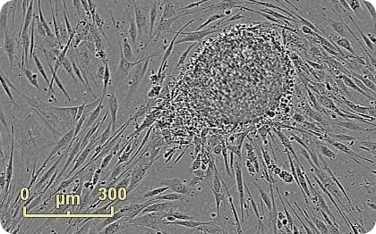 Emerging colony during fibroblast reprogramming