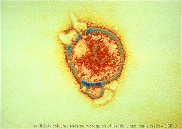 Artificially coloured electron micrograph of Hendra virus: Image credit – CSIRO Artificially coloured electron micrograph of Hendra virus: Image credit – CSIRO
