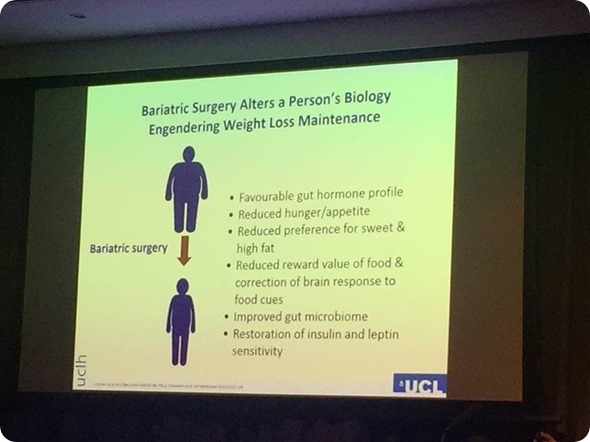 Batterham bariatric surgery