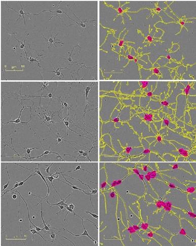 Five neuronal model systems imaged in an IncuCyte ZOOM in phase