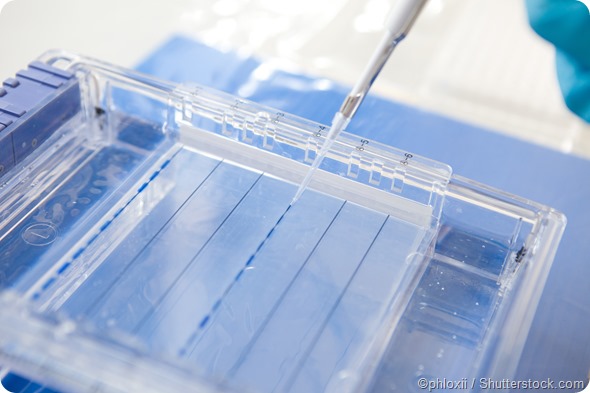 electrophoresis loading gels