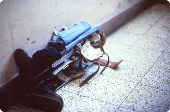 polio patient’s lower limb leg splints lying on a tiled floor