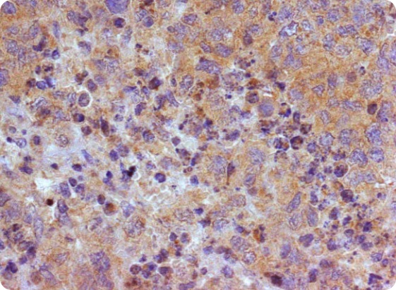 On the trail of TRAIL: monoclonal antibodies promise new chances for ovarian cancer therapy: Image Credit, Michael Krainer