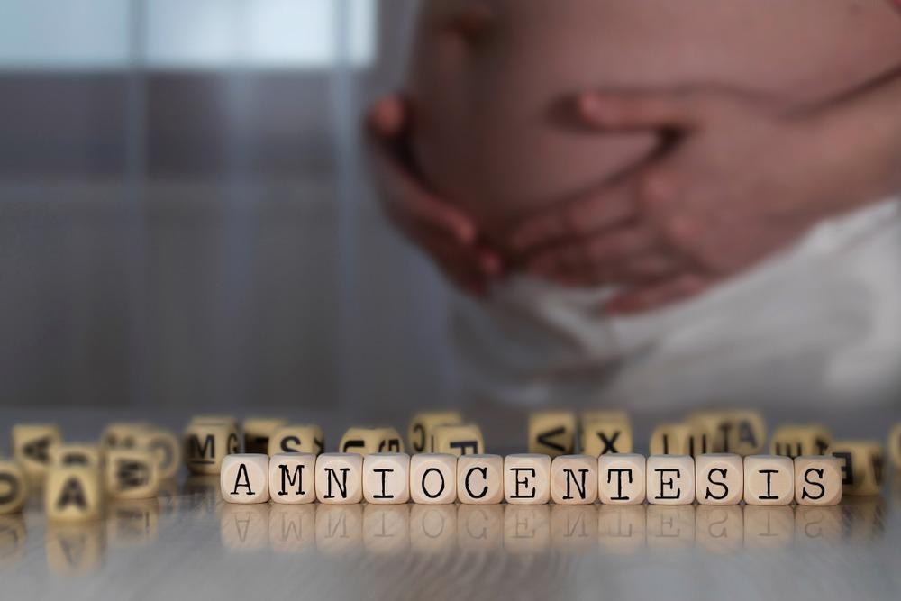 Amniocentesis