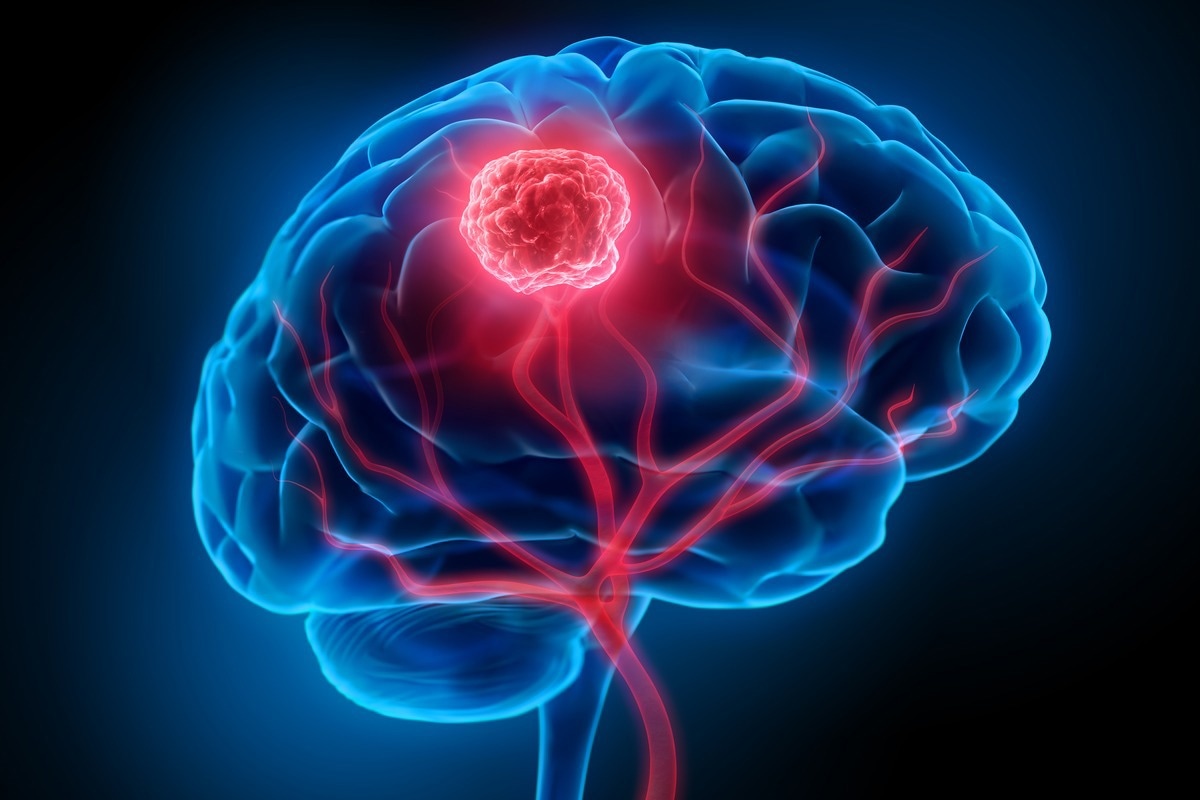 Image Credit: peterschreiber.media/Shutterstock.com