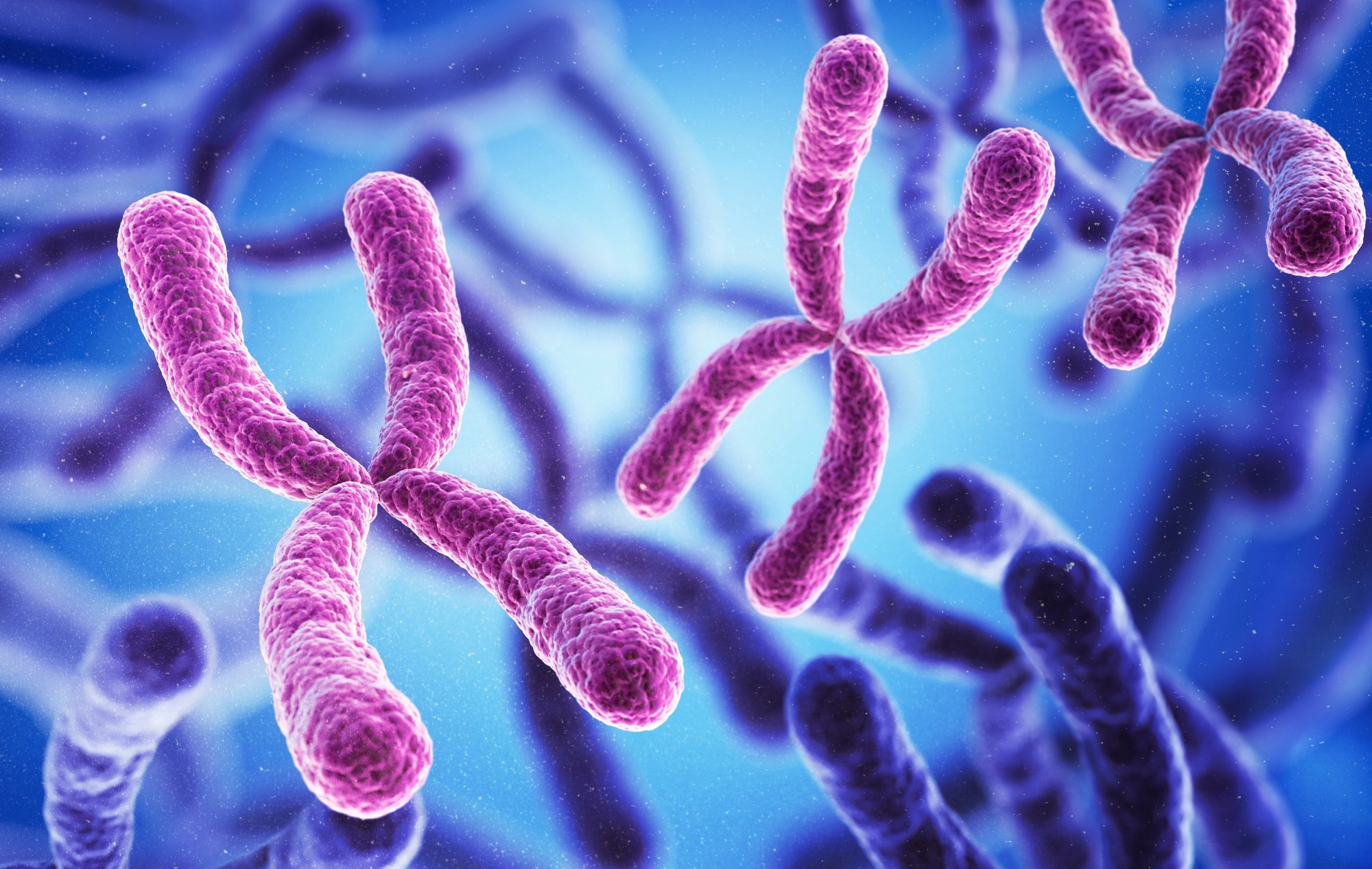 Juberg-Marsidi syndrome