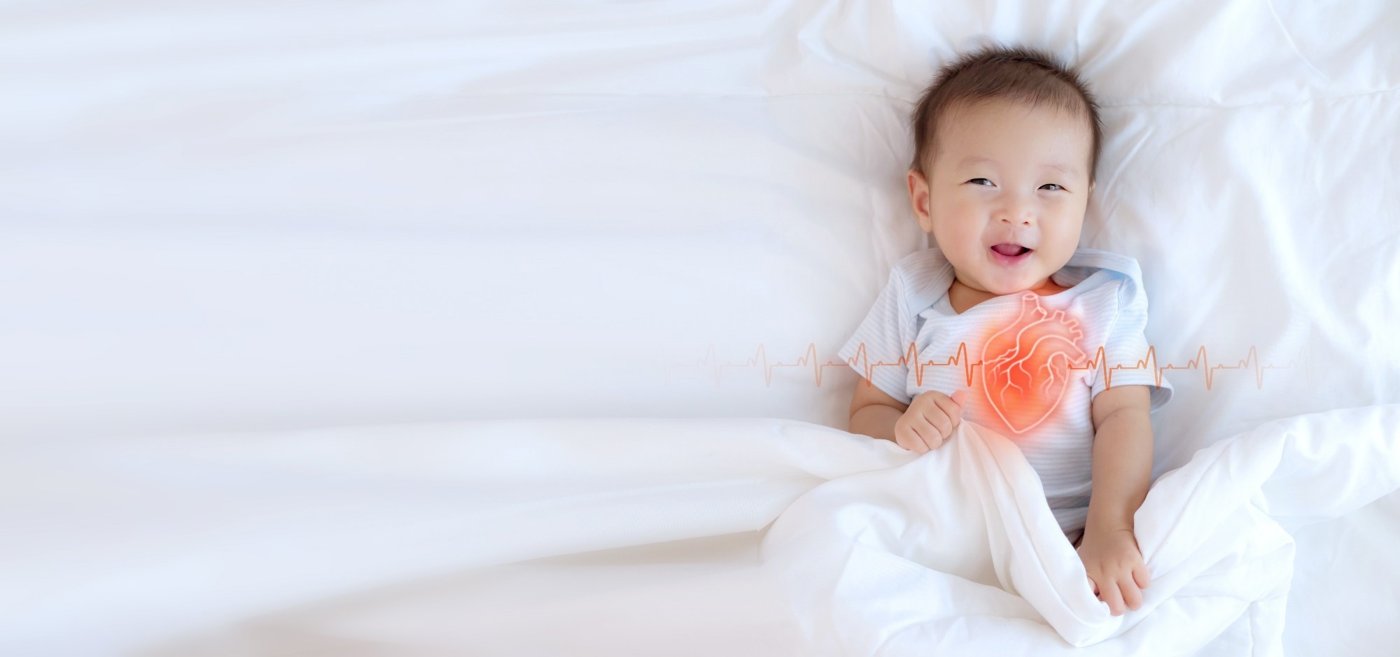 Congenital heart disease has been documented in up to 75% of patients with the VACTERL association