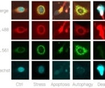 Exploring time-dependent phenotypic changes with live cell painting