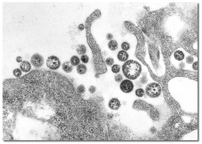Lassa Virus