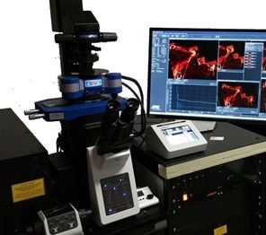 AFM in living cell experiments