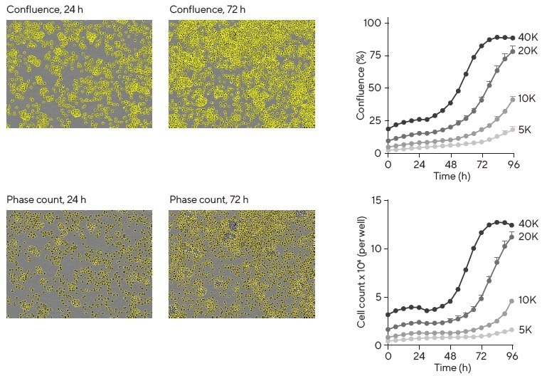 10 common applications of live cell analysis in immunology